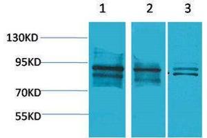 Western Blotting (WB) image for anti-Aryl Hydrocarbon Receptor Nuclear Translocator (ARNT) antibody (ABIN3181520) (ARNT anticorps)