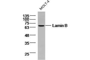 MOLT-4 cell lysates probed with Lamin B (9C11) Monoclonal Antibody, unconjugated (bsm-33040M) at 1:300 overnight at 4°C followed by a conjugated secondary antibody for 60 minutes at 37°C. (Lamin B anticorps)