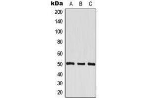 Western blot analysis of EEF1G expression in HeLa (A), HepG2 (B), HL60 (C) whole cell lysates.
