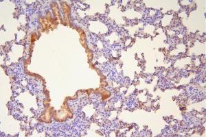 IHC analysis of Hsp20 using anti-Hsp20 antibody (ABIN5518920). (HSPB6 anticorps  (AA 73-123))