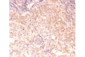 IHC-P: IKK alpha antibody testing of rat spleen tissue