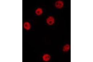 ABIN6277208 staining Hela by IF/ICC. (Histone Cluster 2, H4a (HIST2H4A) (Lys20) anticorps)