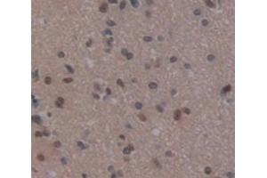 IHC-P analysis of Human Tissue, with DAB staining. (REPIN1 anticorps  (AA 57-314))