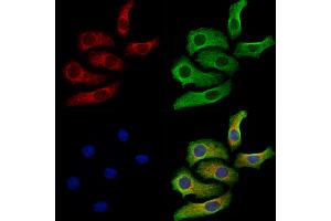 ABIN7094771 and ABIN7098822 staining Hela cells by IF/ICC. (SYNE1 anticorps  (C-Term))