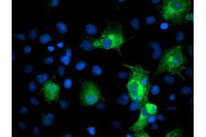 Anti-PFKP mouse monoclonal antibody (ABIN2455337) immunofluorescent staining of COS7 cells transiently transfected by pCMV6-ENTRY PFKP (RC200673). (PFKP anticorps)