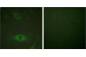 Immunofluorescence analysis of HeLa cells treated with TNF-a 20nM 15', using c-PLA2 (Phospho-Ser505) Antibody. (C-PLA2 (AA 471-520), (pSer505) anticorps)