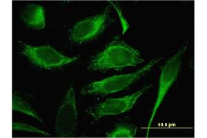 Immunofluorescence of monoclonal antibody to TMSB4Y on HeLa cell.