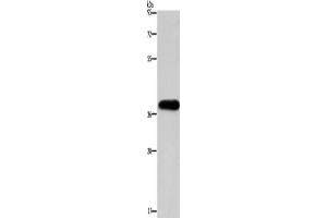 Western Blotting (WB) image for anti-Paired-Like Homeodomain 2 (PITX2) antibody (ABIN2422773) (PITX2 anticorps)
