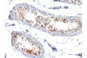 Formalin-fixed, paraffin-embedded human Testis stained with Melan-A / MART-1 Mouse Monoclonal Antibody (MLANA/788). (MLANA anticorps)