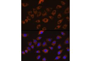 Immunofluorescence analysis of L929 cells using DLG1 Rabbit pAb (ABIN6130273, ABIN6139646, ABIN6139648 and ABIN6224636) at dilution of 1:100 (40x lens).
