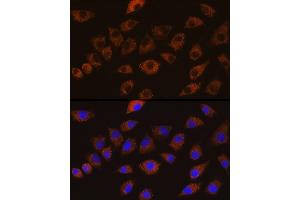 Immunofluorescence analysis of L929 cells using DLG1 Rabbit pAb (ABIN6130273, ABIN6139646, ABIN6139648 and ABIN6224636) at dilution of 1:100 (40x lens). (DLG1 anticorps  (AA 1-190))
