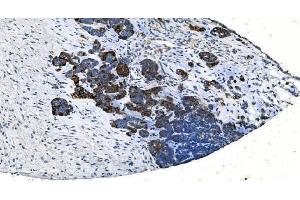 IHC analysis of TMPRSS3 using anti-TMPRSS3 antibody (ABIN7601198). (TMPRSS3 anticorps  (AA 3-454))