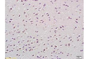 Formalin-fixed and paraffin embedded rat brain labeled with Anti-COX 5B Polyclonal Antibody, Unconjugated (ABIN751318) at 1:200 followed by conjugation to the secondary antibody and DAB staining (COX5B anticorps  (AA 21-120))