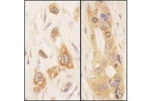 Immunohistochemistry (IHC) image for anti-serine threonine Kinase 39 (STK39) (AA 375-425) antibody (ABIN7453840) (STK39 anticorps  (AA 375-425))