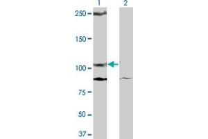Western Blot analysis of KIT expression in transfected 293T cell line by KIT monoclonal antibody (M08), clone 2C3. (KIT anticorps  (AA 41-140))