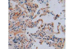 IHC-P analysis of Kidney tissue, with DAB staining. (TNFAIP3 anticorps  (AA 1-300))