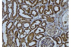 ABIN6274024 at 1/100 staining Rat kidney tissue by IHC-P. (MHC, Class I anticorps)