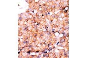 Image no. 2 for anti-V-Akt Murine Thymoma Viral Oncogene Homolog 1 (AKT1) (pSer129) antibody (ABIN358075)