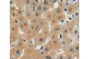 Used in DAB staining on fromalin fixed paraffin-embedded liver tissue (LECT2 anticorps  (AA 1-151))