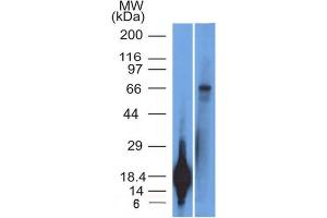 Western Blot Analysis of TRIM29 Recombinant protein fragment & A431 cell lysate TRIM29 Monoclonal Antibody (TRIM29/1042). (TRIM29 anticorps  (AA 1-200))