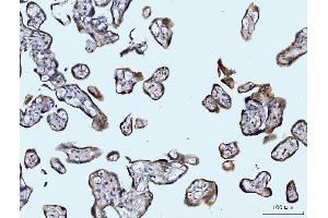 IHC analysis of Glutaminase/GLS using anti-Glutaminase/GLS antibody (ABIN7601602). (Glutaminase anticorps  (AA 396-654))