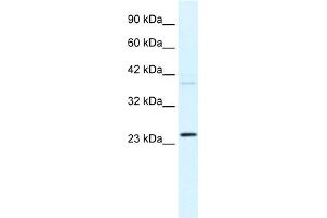 WB Suggested Anti-FREQ Antibody Titration:  0. (NCS1 anticorps  (N-Term))