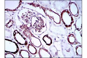 Immunohistochemical analysis of paraffin-embedded kidney tissues using SYCP3 mouse mAb with DAB staining.