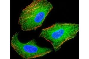 Fluorescent image of HeLa cells stained with TSC2 antibody.