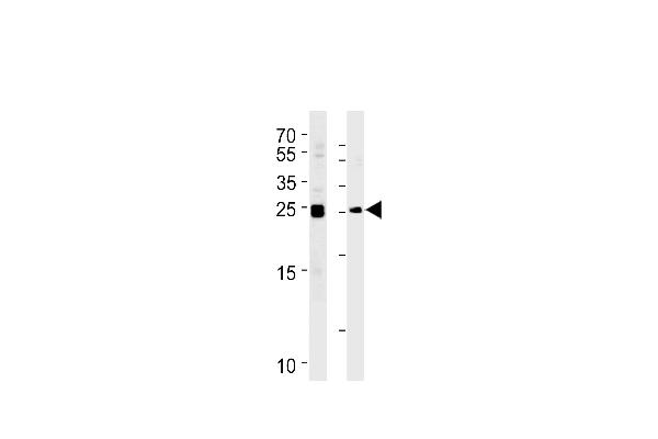 MOBKL1A anticorps  (C-Term)