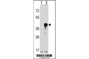 Western blot analysis of C4BPB using rabbit polyclonal C4BPB Antibody using 293 cell lysates (2 ug/lane) either nontransfected (Lane 1) or transiently transfected (Lane 2) with the C4BPB gene. (C4BPB anticorps  (AA 125-153))