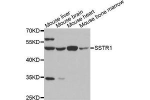 Western blot analysis of extracts of various tissues, using SSTR1 antibody. (SSTR1 anticorps)