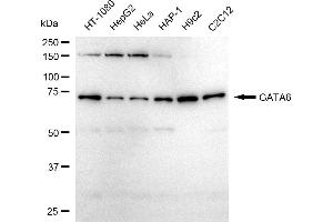 Western blotting analysis using GATA6 antibody (ABIN7798697).