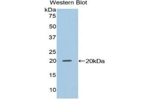 Detection of Recombinant NME2, Mouse using Polyclonal Antibody to Non Metastatic Cells 2, Protein NM23B Expressed In (NME2) (NME2 anticorps  (AA 8-149))