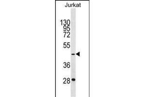GTF3A Antibody (C-term) (ABIN1537104 and ABIN2850137) western blot analysis in Jurkat cell line lysates (35 μg/lane). (GTF3A anticorps  (C-Term))