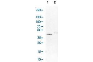 Western Blot analysis of Lane 1: NIH-3T3 cell lysate (mouse embryonic fibroblast cells) and Lane 2: NBT-II cell lysate (Wistar rat bladder tumour cells) with GALT polyclonal antibody . (GALT anticorps)