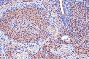 Immunohistochemistry of paraffin-embedded rat ovary using MSH2 Rabbit mAb (ABIN7268547) at dilution of 1:100 (40x lens). (MSH2 anticorps)