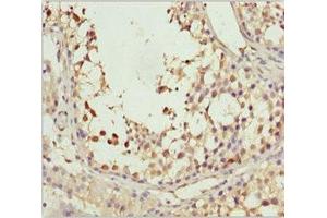 Immunohistochemistry of paraffin-embedded human testis tissue using ABIN7170649 at dilution of 1:100 (SPRED2 anticorps  (AA 120-300))