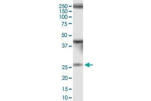 IQCF1 monoclonal antibody (M01), clone 1H4. (IQCF1 anticorps  (AA 1-205))