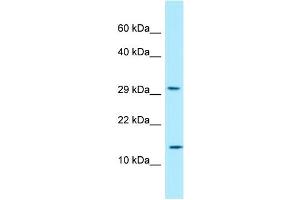 WB Suggested Anti-RPLP2 Antibody Titration: 1. (RPLP2 anticorps  (N-Term))