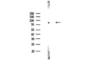 Western blot analysis of lysates from Rat testis, using RFX3 Antibody at 1/1000 dilution.