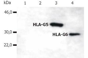 Western Blotting analysis of whole cell lysate of HLA-G stable transfectants (various splice variants) using anti-human HLA-G (5A6G7). (HLAG anticorps  (C-Term) (PE))