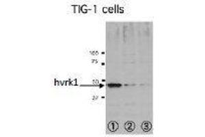 Western Blotting (WB) image for anti-Vaccinia Related Kinase 1 (VRK1) (N-Term) antibody (ABIN2452161)