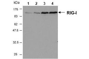 anti-DEAD (Asp-Glu-Ala-Asp) Box Polypeptide 58 (DDX58) (AA 201-713) antibody