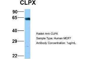 Host: Rabbit Target Name: NOP56 Sample Type: MCF7 Antibody Dilution: 1. (CLPX anticorps  (C-Term))