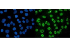 IF analysis of DMAP1 using anti-DMAP1 antibody (ABIN7601999). (DMAP1 anticorps  (AA 54-401))