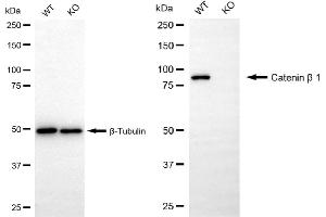 Western blotting analysis using catenin beta 1 antibody (ABIN7797931).