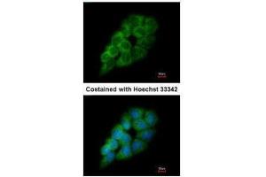 ICC/IF Image Immunofluorescence analysis of methanol-fixed A431, using DARS, antibody at 1:200 dilution. (DARS anticorps)