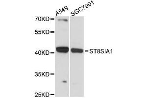 Western blot analysis of extracts of various cell lines, using ST8SIA1 antibody (ABIN5996532) at 1:3000 dilution.