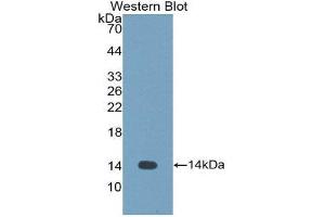 Western Blotting (WB) image for anti-Cystatin-Like 1 (CSTL1) (AA 21-114) antibody (ABIN1176755) (CSTL1 anticorps  (AA 21-114))