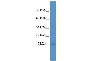 WB Suggested Anti-Ier3ip1 Antibody Titration:  0. (IER3IP1 anticorps  (N-Term))